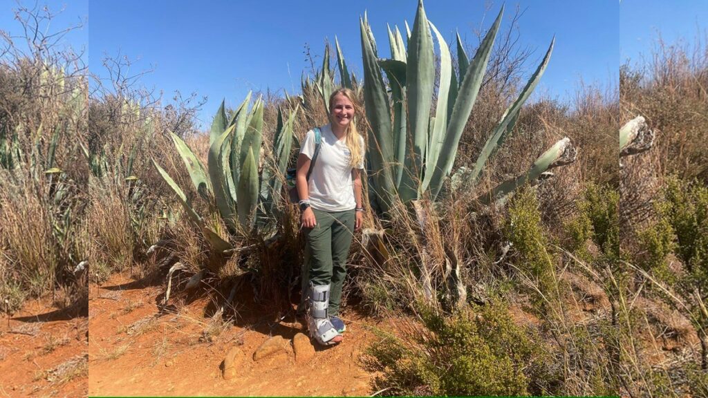 Brook Cheuvront wears medical boot outdoors