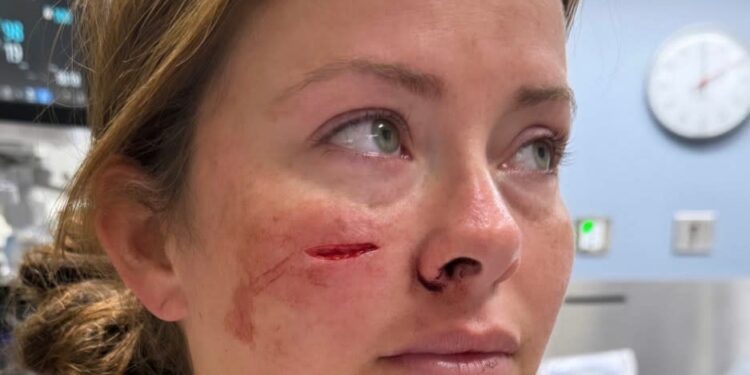 Melissa Mauldin was stabbed in the face on Sunday. Obtained by NY Post