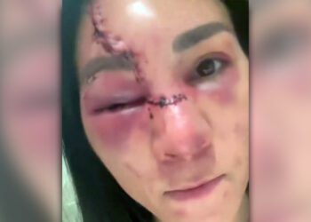 Irene Aldana’s UFC 306 cut barely noticeable (OK, that’s a lie)