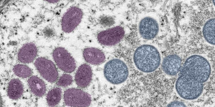 This digitally colorized electron microscopic image depicts monkeypox virus particles.